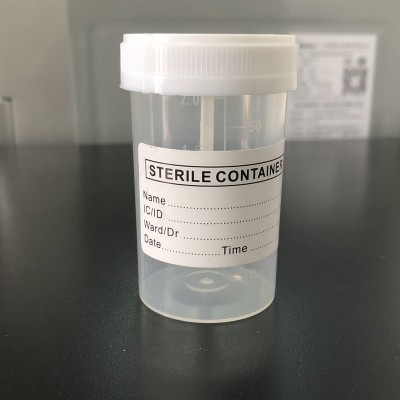 good prices sterile disposable male female medical test sample hospital 60ml urine specimen container cup